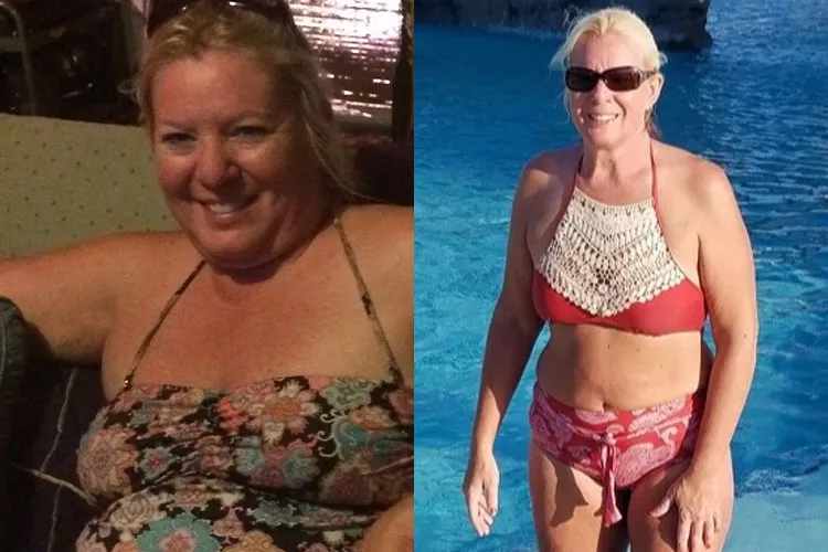 Before-and-after weight loss transformation: a woman in floral top (left) and red bikini by a pool (right)